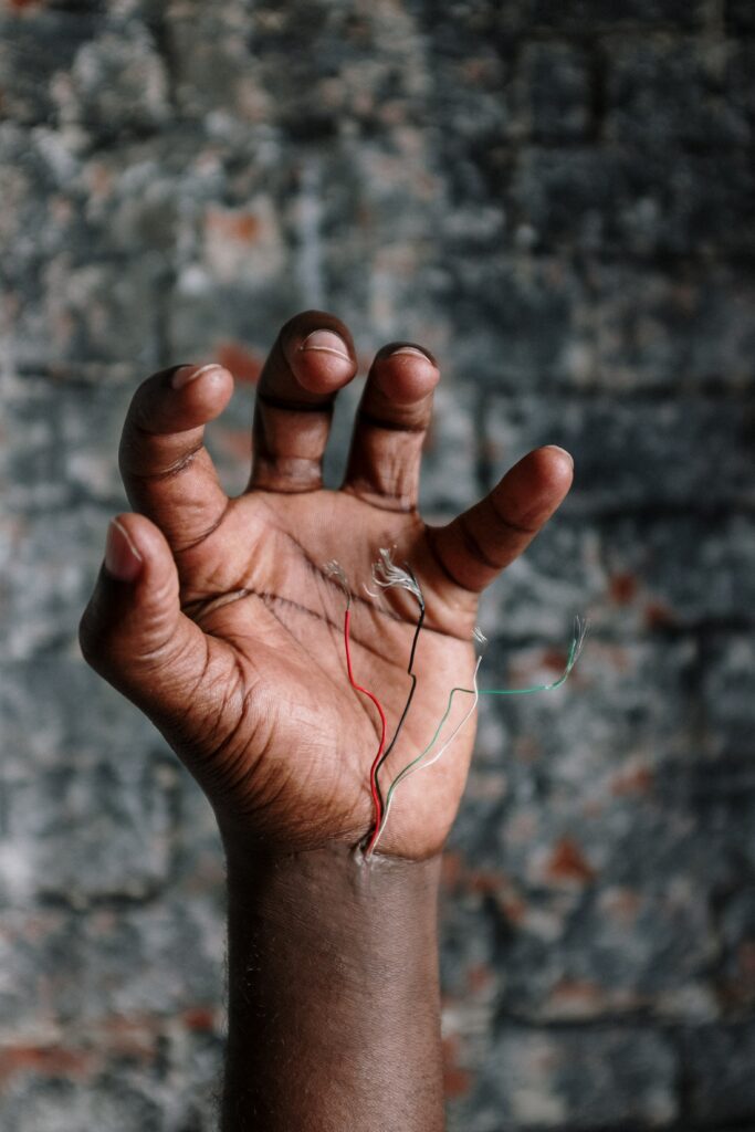 A photograph of a hand, curled up as if in pain. Frayed wires, in four colours, emerge from the wrist of the hand, implying that the person has wires for veins.
